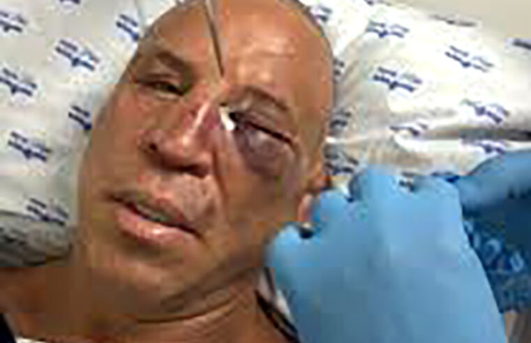 A versão de Wanderlei Silva após briga generalizada com Popó no Spaten Fight Night