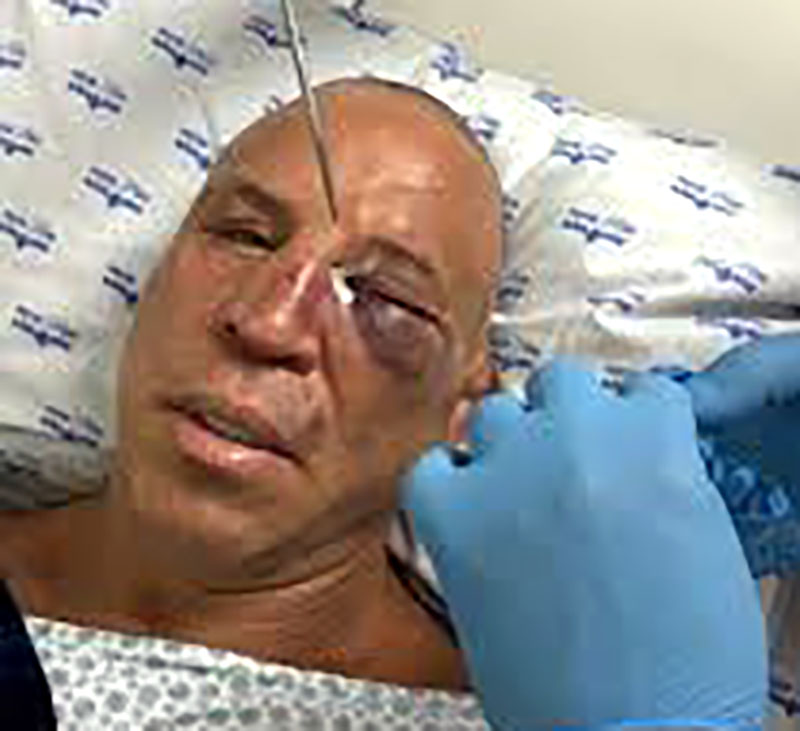 A versão de Wanderlei Silva após briga generalizada com Popó no Spaten Fight Night